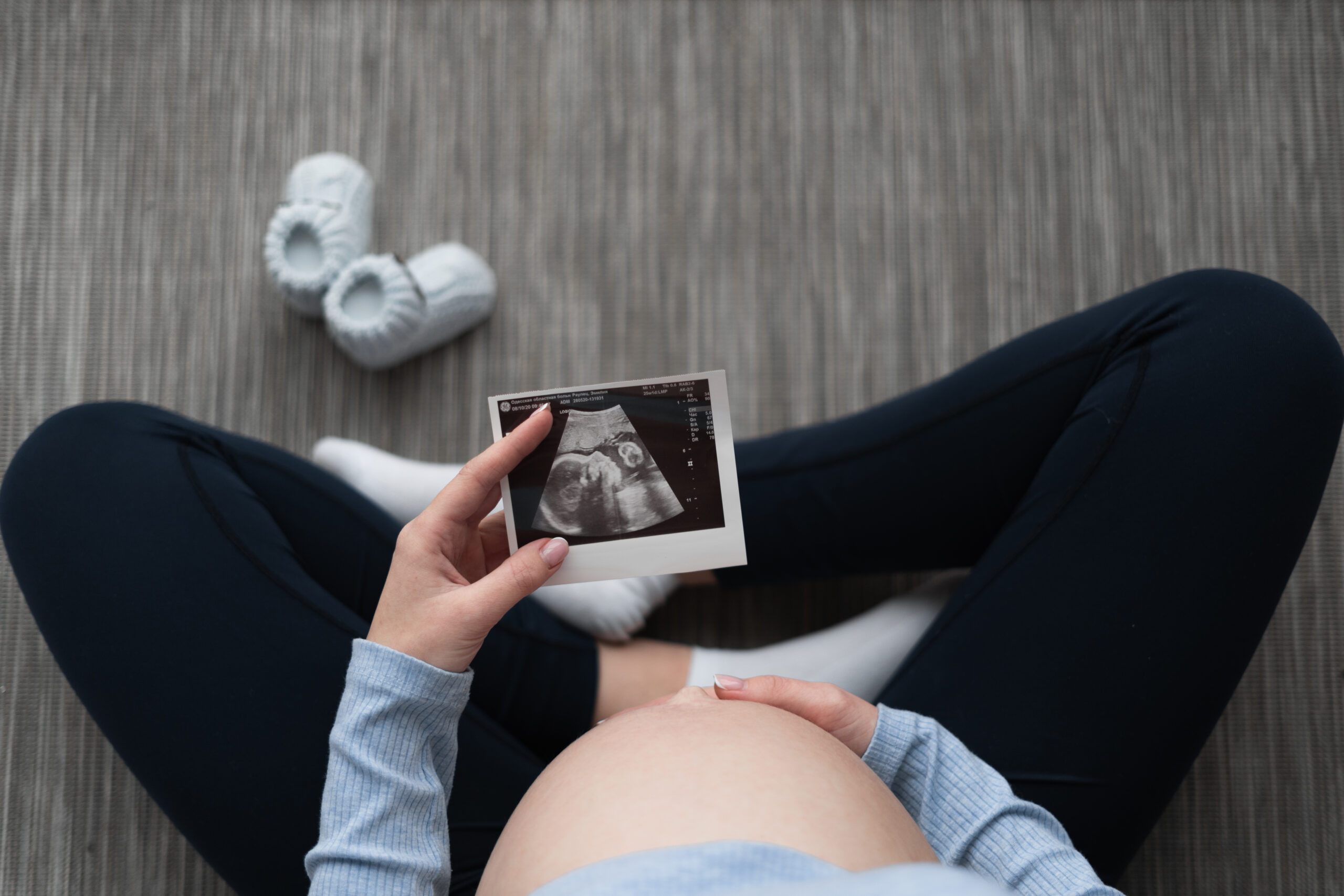 top view of a young pregnant woman sitting on the floor. Keeps the ultrasound of the baby near the abdomen.